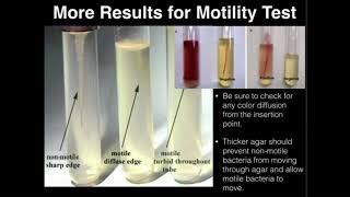 Motility Test – Principle, Procedure, Uses and 